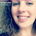 Why I got braces as an adult (and how it’s going)